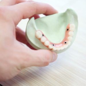 Tandprotetikeren – din professionelle tandtekniker